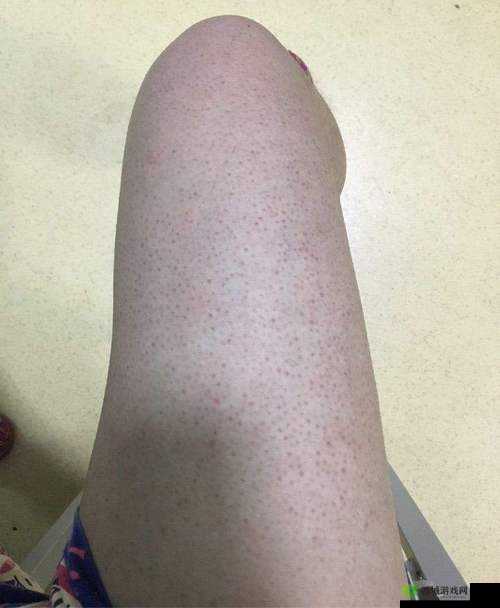 鸡皮疙瘩第关重生攻略：如何过关？