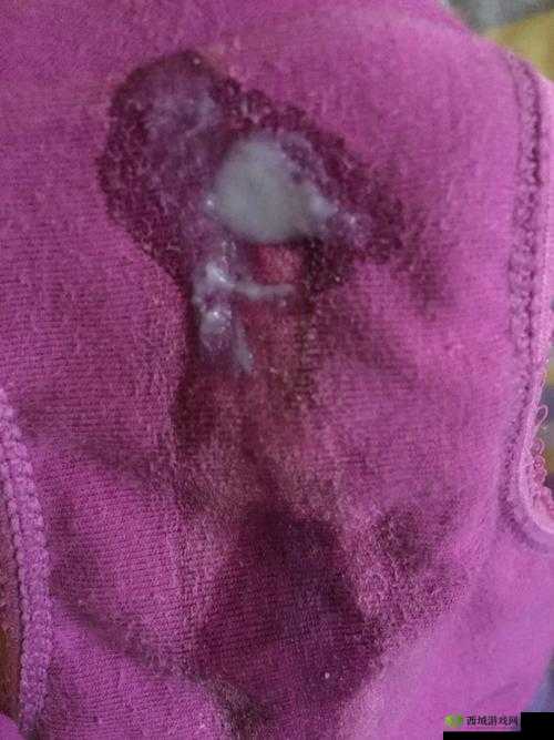 女生流出白白的东西是怎么回事?