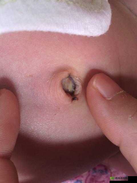 宝宝下面湿透了还嘴硬疼咋回：宝宝身体不适，需及时就医