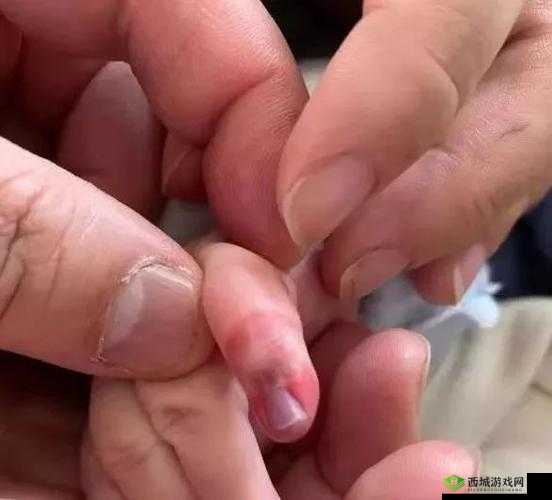 宝宝才三根手指就这么疼：手指插入的疼痛体验