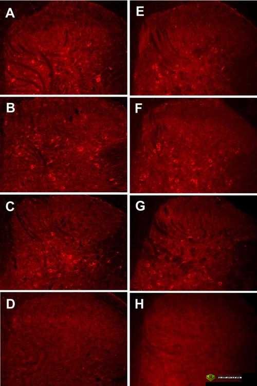 药效 1v2hpo 江漾治疗解析：深度探究与应用