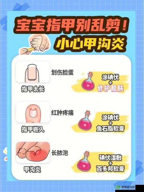 宝宝三根手指痛原因何在