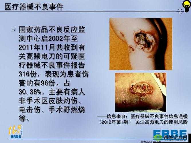 老中医用嘴排阴毒小雨：令人震惊的医疗事件