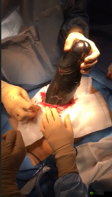 拔萝卜痛又降黄 9.1:奇特现象引发关注