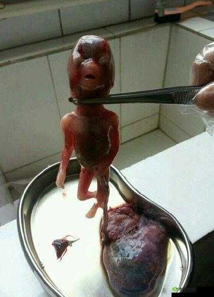 胎头湿漉漉挤出:生命诞生的震撼瞬间