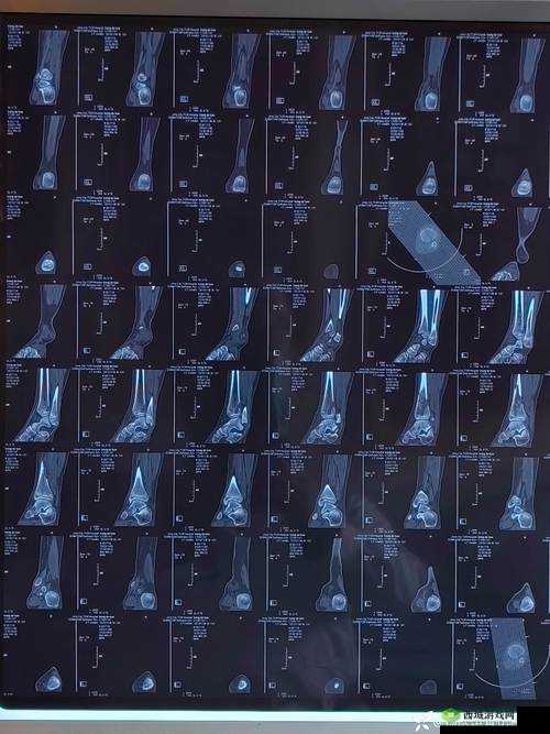 骨科 1V2H:独特的医疗领域探索