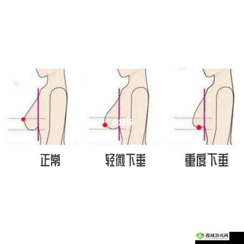 20 岁胸又软又下垂，正常吗？