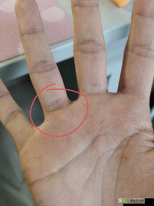 才一根手指头就喊疼是什么意思：探究背后缘由