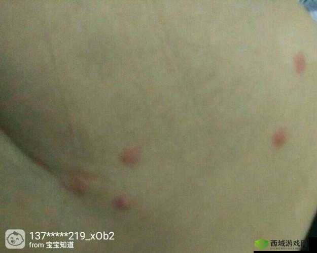 两个蛋蛋摸起来里面有疙瘩，需进一步检查