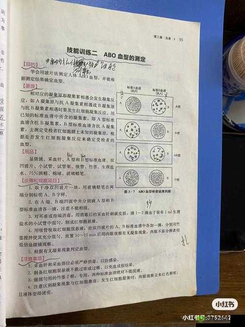 DayZ角色血型揭秘：血型检测方法与步骤详解