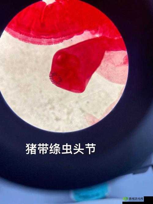 医院计划：猪肉绦虫详症状分析——绦虫感染的全方位解读