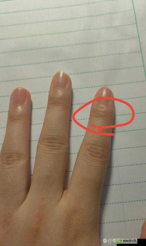 一根手指就疼了：到底怎么回事