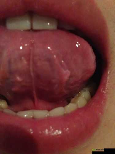 以往下面放像舌头之物相关