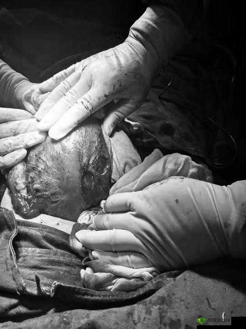 PRONXXXXHD分娩:一种特殊的分娩方式