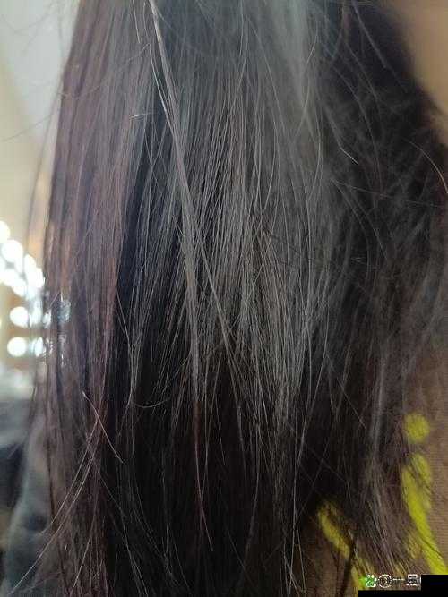 女生下面变黑色是什么原因：专业医生解惑