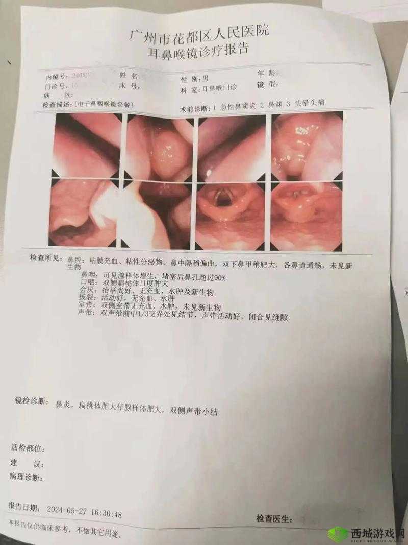 每次跟男朋友口完后嗓子发炎的困扰及应对措施