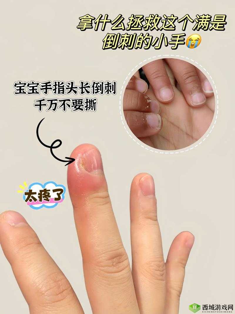 宝宝才两根手指就疼哭了：探究原因与解决方法