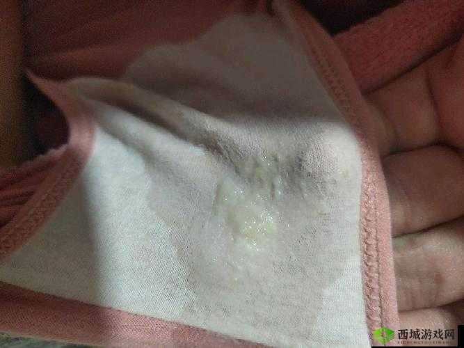 镜流口水白色液体现象正常吗：对此现象的深入分析与探讨