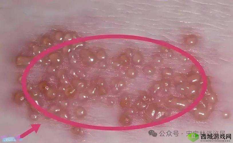 女生第一次过后出血是为什么原因:全面细致的专业解读